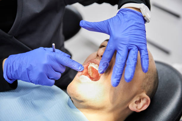 Best Emergency Broken Tooth Repair in Belleair, FL